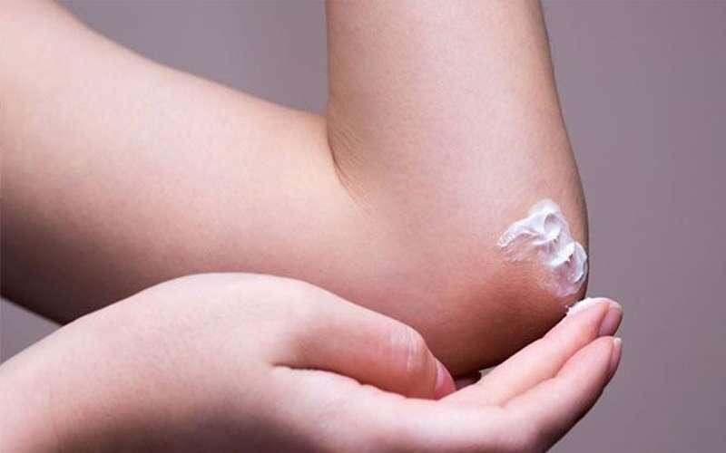 بهترین روش‌های خانگی برای رفع تیرگی زانو و آرنج